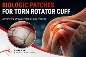 Biologic Patches for Torn Rotator Cuffs: Advancing Shoulder Repair and Healing